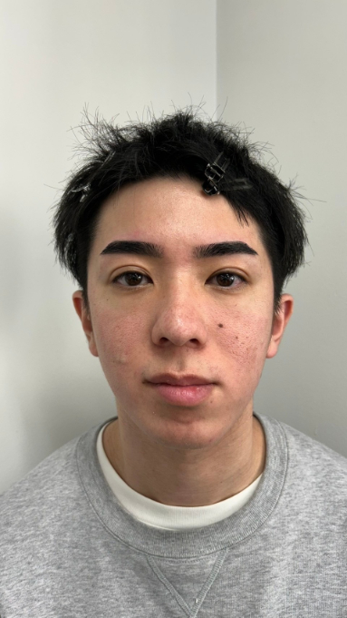 眉毛がボサボサの人のアフター